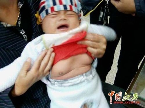 江西抚州4月大婴儿性早熟 疑因食用奶粉(图)